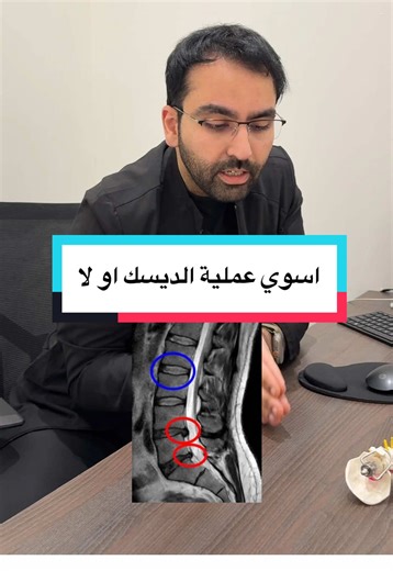 علاج الانزلاق الغضروفي: العملية أم العلاج التحفظي؟