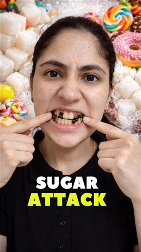 How Cavities Form | Tooth Decay Explained