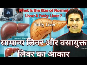 Liver [ Part-2] Size of the Normal Liver and Fatty Liver. #health #education #upsc #fattyliver