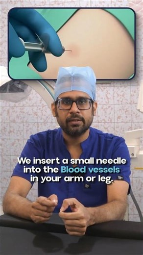 Angiogram Explained | Pain இருக்கா இல்லையா?