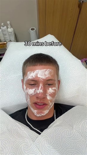 @shapedhaus | micro needling