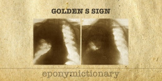 Golden S sign