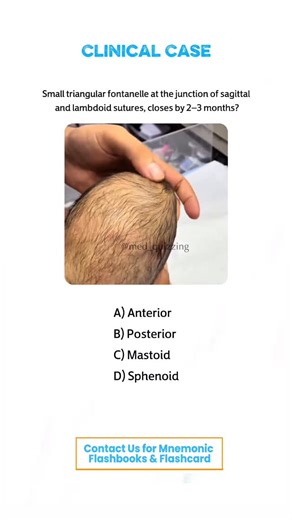 𝑴𝒆𝒅 𝑸𝒖𝒊𝒛𝒛𝒊𝒏𝒈 on Instagram: "Comment “Details” and check your inbox for the full mnemonic flashbook & flashcards! 📕✨ . . . . . . #medical #medicine #medicalstudent #medicinestudent #usmle #step1 #plab #mrcp #medicine #reels #viral #foryou #anatomy #reelexplore #instagram #neurology #nephrology #surgery #students #colleges #cardiology #knowledge #virals #plab #UK #USA #newyork #nyc #neet"