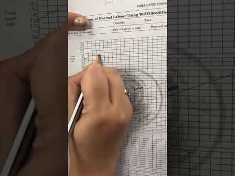 Part 03 || How to fill partograph