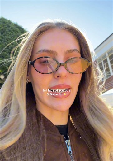 Complete Wedding Prep: Botox and Sculptra Transformation