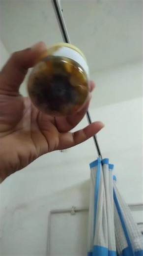 gall bladder stone removal😲😲#removalshort#