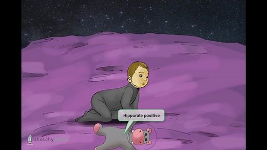 Streptococcus Agalactiae (Group B Strep) - Free Sketchy Medical Lesson