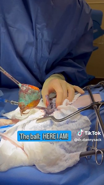 🎾 What’s the dumbest thing your dog has tried eating?? 🐶Toys are sometimes what make our pets the happiest but MAKE SURE it’s not one that they can swallow! 🫠This pup thought that a foam ball was a great idea for a snack. While I’m sure it tasted great, unfortunately that didn’t last and he needed surgery for a stomach obstruction. Thankfully he did great and is back to chewing on less edible/swallowable objects. #surgery #dog #vetmed #residency #emergency