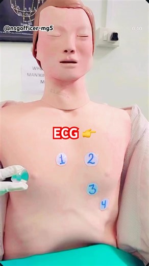 😃 ECG Lead positioning #youtubeshorts #shortsfeed #medicalprocedure #ecg #ecgtest