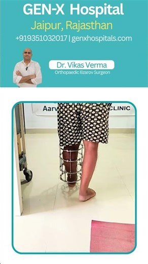 From Deformity to Walking Again | Ilizarov Surgery Transformation