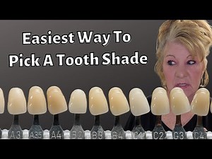 How To Pick A Tooth Shade For Your Dentures