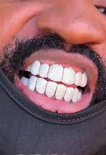 Custom Grillz Reviews from SSS The Jeweler
