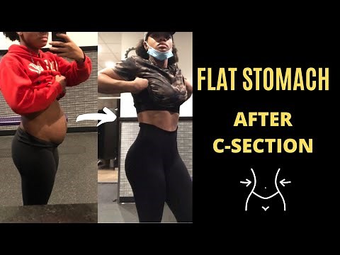 HOW TO GET A FLAT STOMACH AFTER C-SECTION |How to get rid of mommy pooch after baby