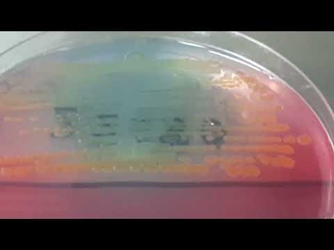 Colony morphology of Citrobacter freundii on CLED Agar
