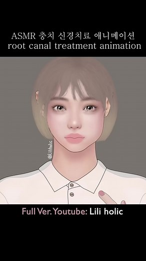 [ASMR] dental root canal treatment #dental #rootcanal #asmr #animation #fbreels | Mood For Fun