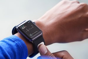 First FDA-certified Apple Watch accessory is AliveCor's Kardia Band EKG meter | AppleInsider