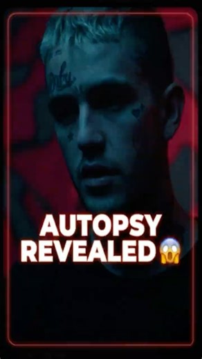 "Lil Peep Autopsy Revealed… Shocking Details in 60 Seconds 💀" #LilPeep #LilPeepAutopsy #PeepLegacy