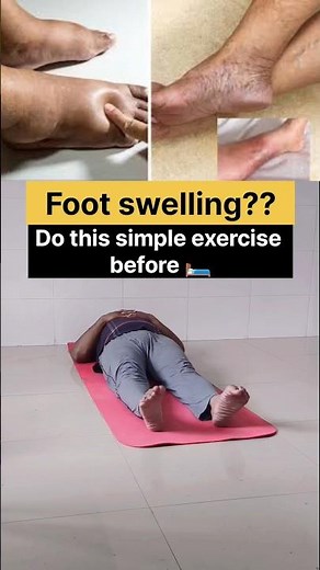 Simple Bedtime Exercises to Reduce Foot & Ankle Swelling (Edema) 🦵✨