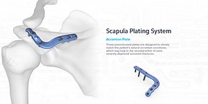 Scapula Fractures