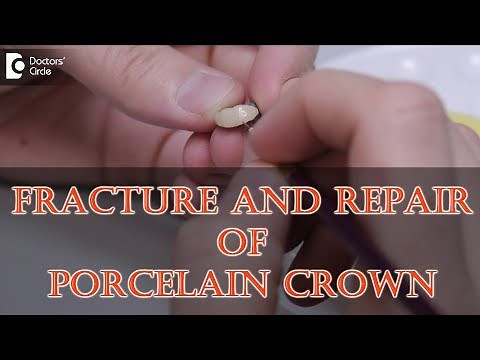 How can porcelain crowns break ? Can you fix a chipped porcelain crown? - Dr. Manesh Chandra Sharma