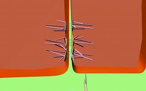 【细胞生物学】桥粒desmosome