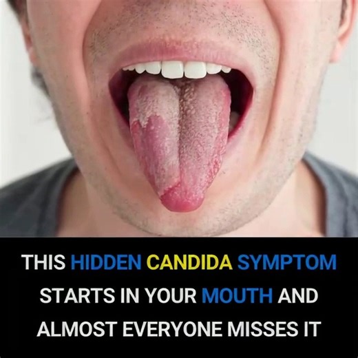 Top Signs That You Have Candida Infection and What to Do About It | K Line Global