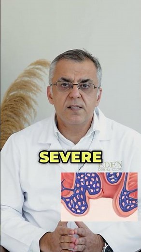 Anal Fissure Treatment with Botox Injection | Non-Surgical Pain Relief Explained