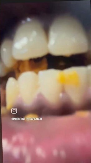 #mouthsounds #mouthcam #girl #giantess