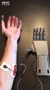 This 3D printed prosthesis is controlled with an Arduino nano 🤚 | UNILAD Tech