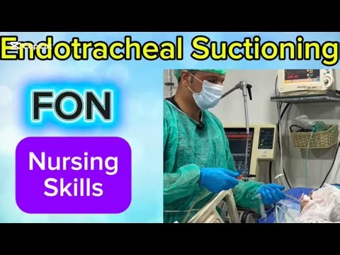 How to Perform Endotracheal Suctioning: A Complete Nursing Guide