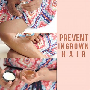 2.3M views · 453 shares | Are ingrown hair constantly bothering you? Here are some easy tips to prevent and get rid of them! | Glamrs | Facebook