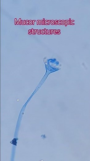 Spores, sporangium and sporangiophore of Mucor #science #mycology