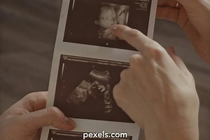 Human Body Scan Videos, Download The BEST Free 4k Stock Video Footage & Human Body Scan HD Video Clips
