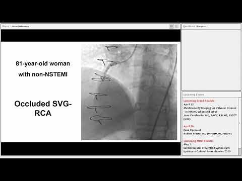 Emmanouil Brilakis - Update on Chronic Total Occlusion (CTO) Percutaneous Coronary Intervention