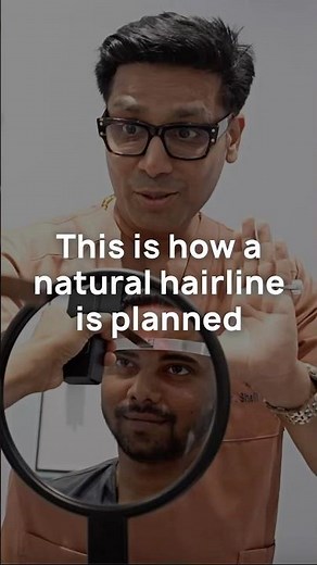 Natural Looking Hairline Design And Restoration | Critical Mistakes to Avoid in Hairline Restoration