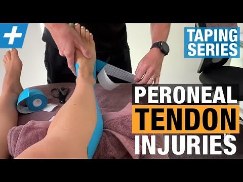 How to Tape for Peroneal Tendon Injuries