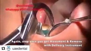 RepostBy @uaedental: ・・・ PHYSICS FORCEPS Set Includes: GMX 100UR Upper Right GMX 100UL Upper Left GMX 100UA Upper Anterior GM | يوميات طبيب أسنان Dentist Daily Diary Dr Zeyad Alweher