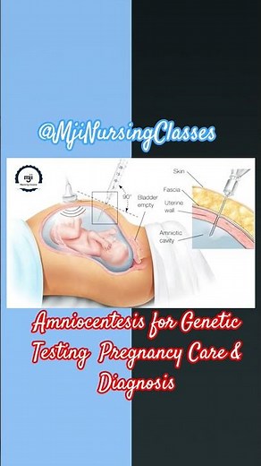 Amniocentesis for Genetic Testing | Pregnancy Care&Diagnosis #norcet2025#nurseryrhymes#nursingcareer