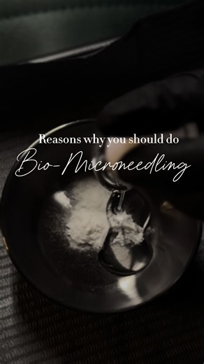 Most skincare treatments work on the surface of the skin. Bio-microneedling works deeper. This treatment uses natural spicules to create thousands of microscopic pathways in the skin, stimulating collagen production and increasing cellular turnover — without traditional needles. Over the next 7–14 days your skin begins to regenerate, helping improve: • Acne scarring • Texture • Fine lines • Pigmentation • Overall skin firmness It’s one of our favorite treatments for clients who want real skin ch