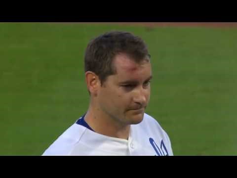 We Just Saw One of The Scariest Injuries You Will Ever See on an MLB Field