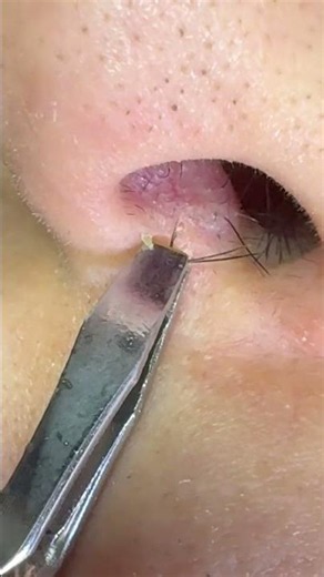 Pure Pluck Sounds — Nose Edition