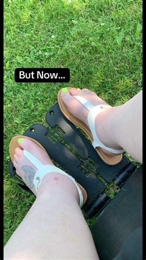 Swollen feet were becoming my “normal.” So I tried a vibration plate every day… and my feet said THANK YOU. 🖤🦶✨ #w#wheelchairlifed#disabledtiktoks#swollenfeeth#healthhackvibrationplate