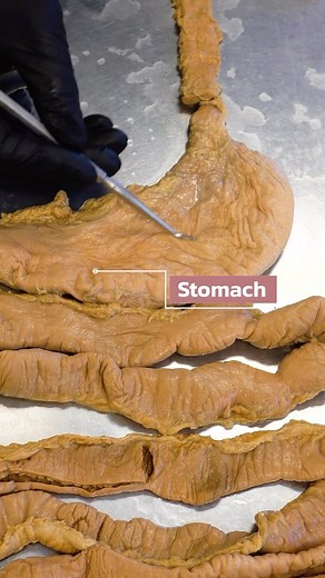 133K views · 1K reactions | How Your Body Absorbs Sugar #sugar #sucrose #digestion #stomach | Institute of Human Anatomy | Facebook