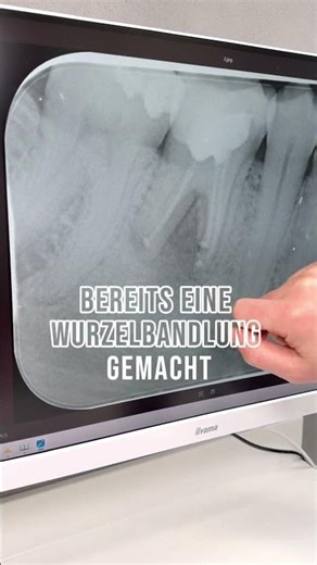 Aus dem Praxisalltag: Eine Zyste muss nicht weh tun