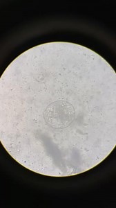 Stool sample ❤️😲😲😲 | Lab life