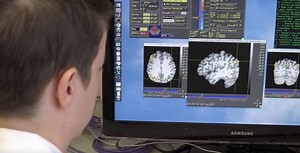 Stimulation Excites the Brain to Form Better Memories - News Center