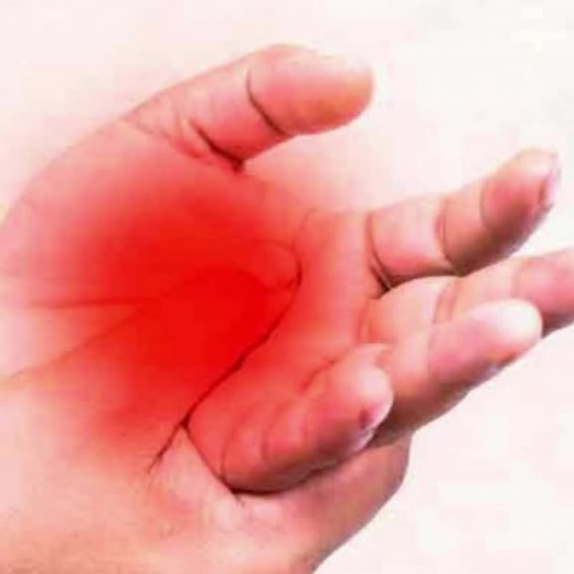 _neurored_ on TikTok