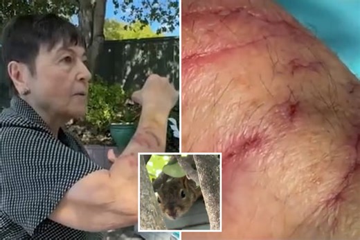 Squirrel attacks send 2 people to the ER with warning it 'appears from nowhere'