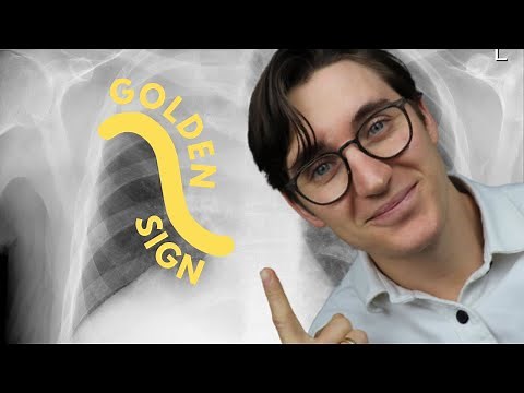 The Golden S Sign - EXPLAINED