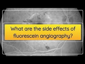 What are the side effects of fluorescein angiography?